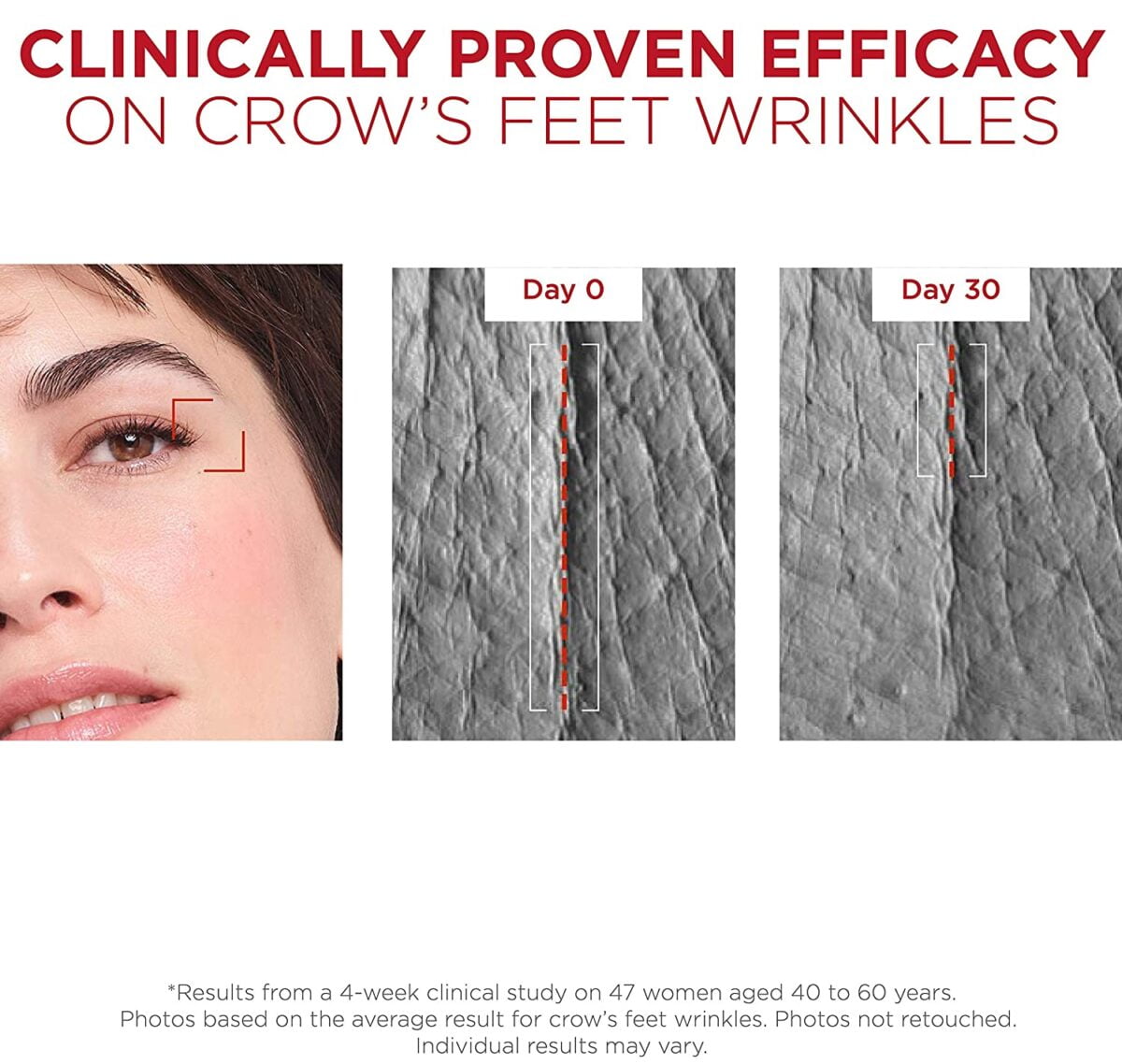 Vichy Liftactiv Peptide C Ampoules Pure Vitamin C
