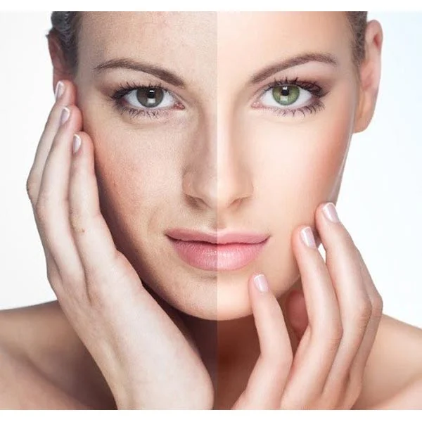 ROC Toner 200ml Perfecting Toner Lotion All Skin Types Even Sensitive ROC Toner 200ml Perfecting Toner Lotion All Skin Types Even Sensitive