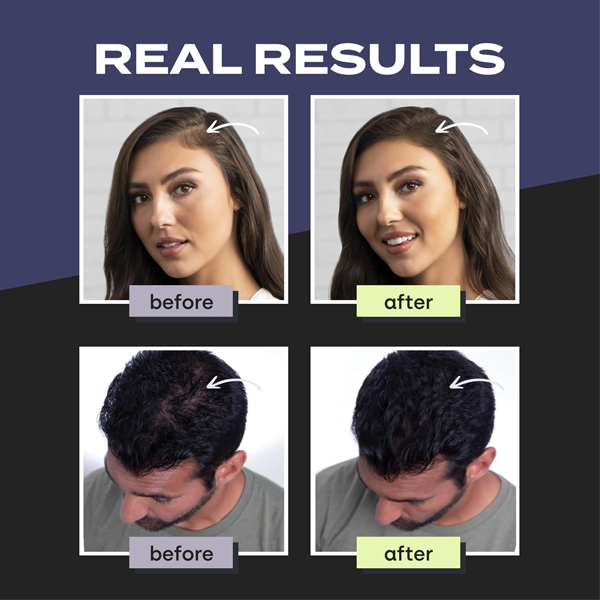 Toppik Hair Building Fibers Med Brown 27.5g